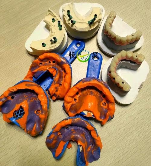 红膏取模方法的关键步骤与操作技巧有哪些?-图3 红膏取模方法的关键步骤与操作技巧有哪些?-图3