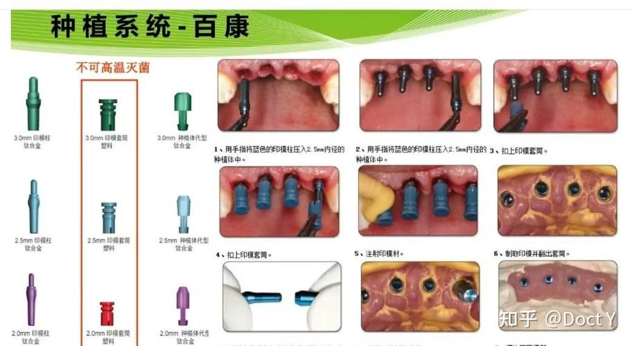 种百康牙一颗的种植费用大概需要多少钱呢？-图2
