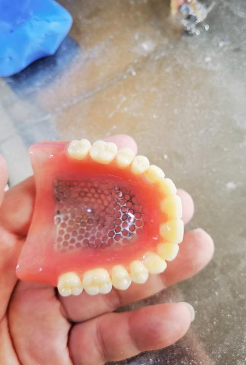 胶托排牙方法的具体操作步骤是怎样的？有哪些关键技巧需要掌握？-图2