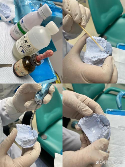 正畸双曲舌簧弯制方法的核心要点是什么?-图3 正畸双曲舌簧弯制方法的核心要点是什么?-图3