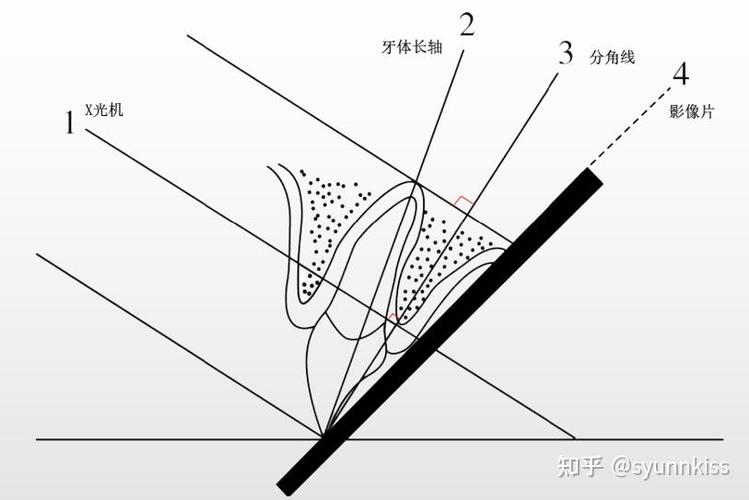 牙科摄片方法-图2