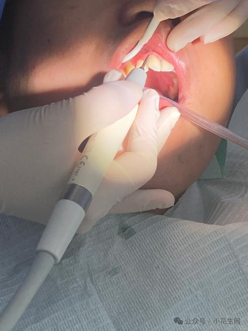 北大口腔医院牙齿正畸效果如何？适合哪些人群？-图3