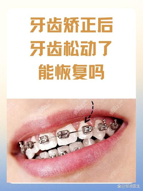 正畸后牙齿松动怎么办-图2
