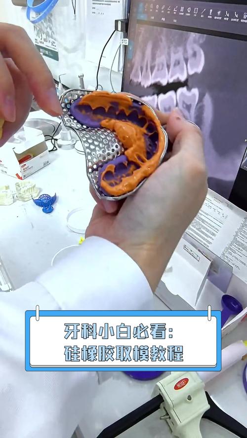 牙齿取模方法-图2