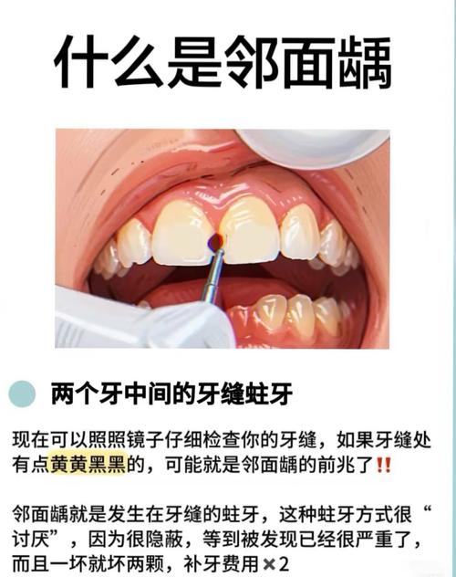 牙缝变小方法-图3