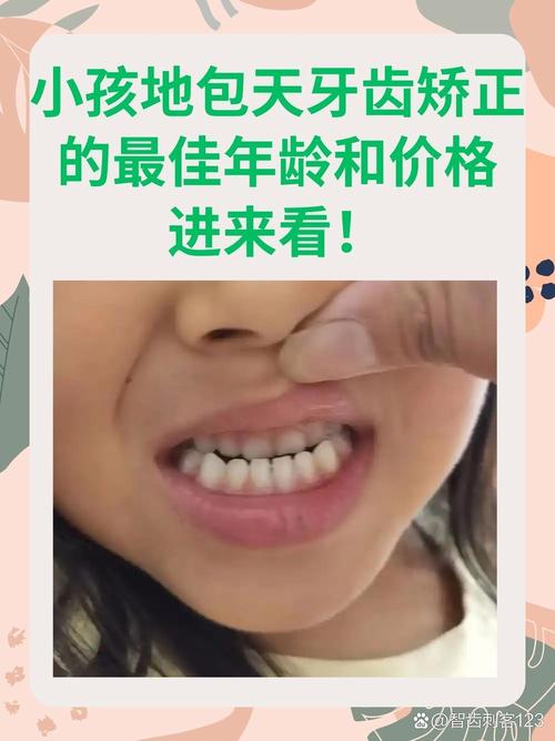 小孩骨性龅牙能正畸吗-图3