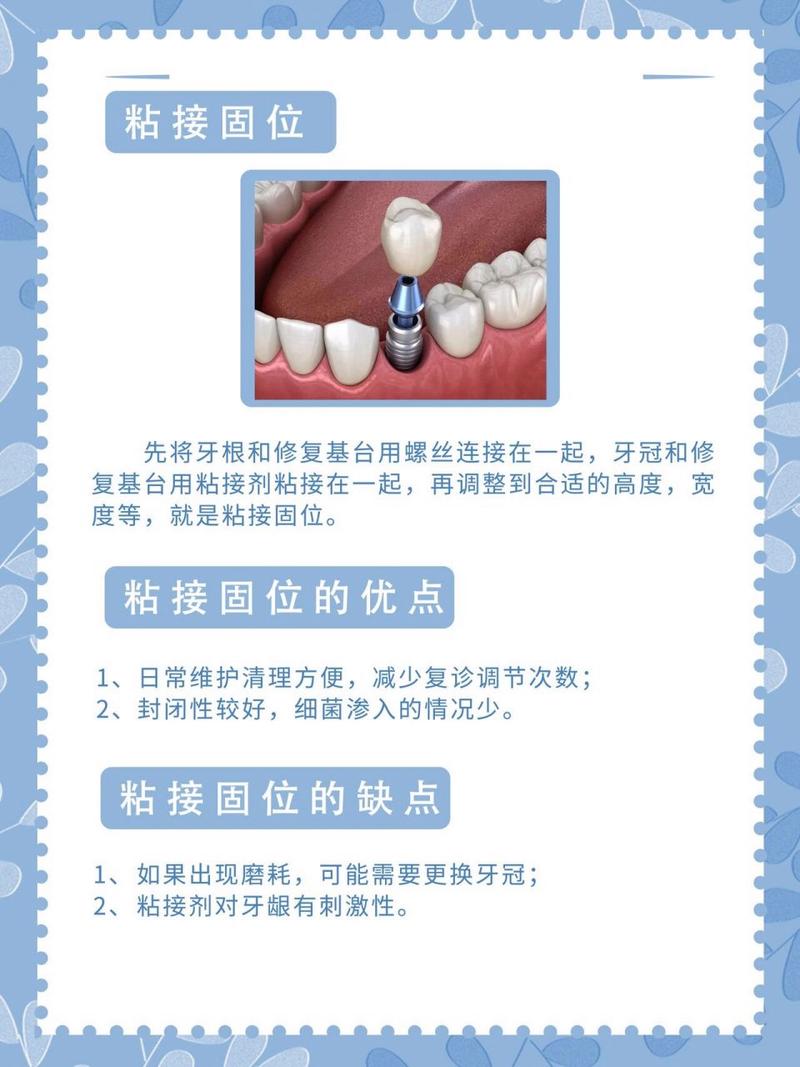 冠修复的方法-图2