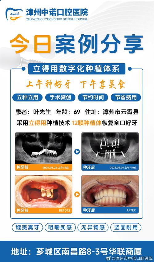 种牙都是微创吗-图3