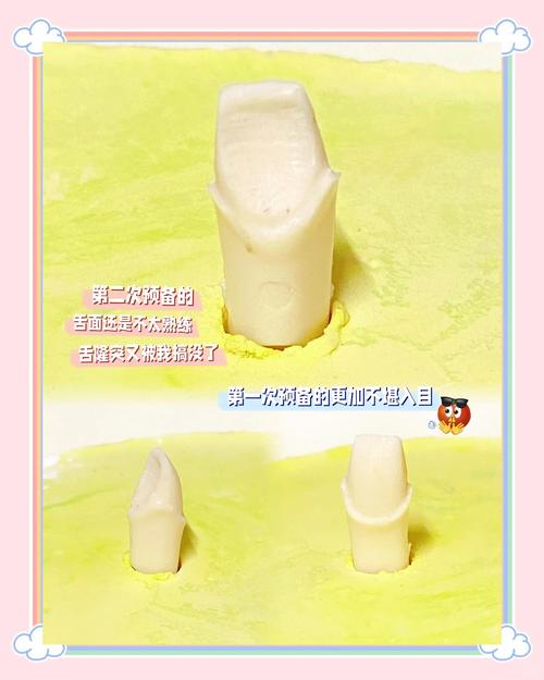 基牙预备常用方法有哪些？操作步骤及临床注意事项是什么？-图2