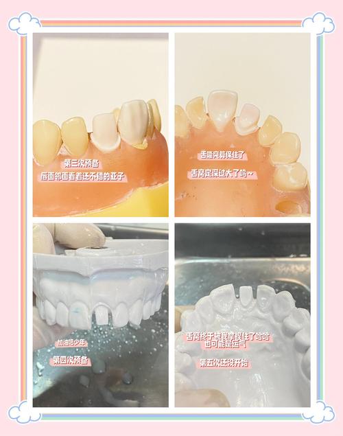 基牙预备常用方法有哪些？操作步骤及临床注意事项是什么？-图1