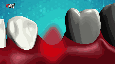 种牙过程动态图-图3