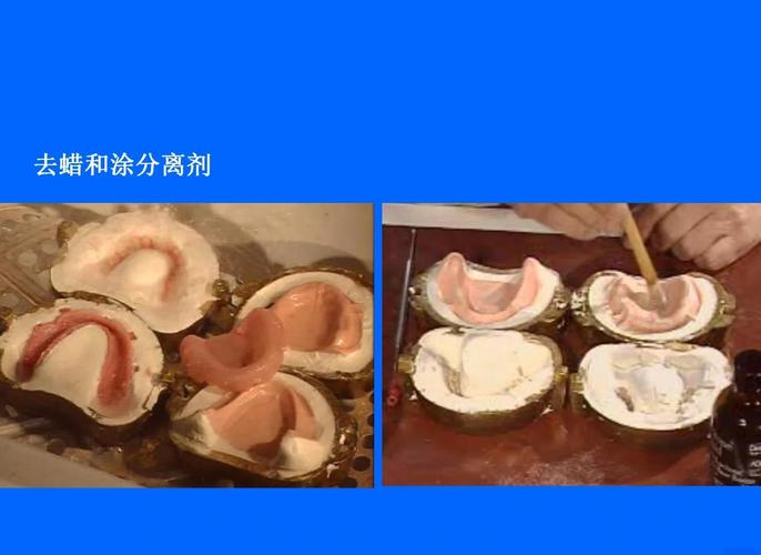 牙齿自作方法-图1 牙齿自作方法-图1