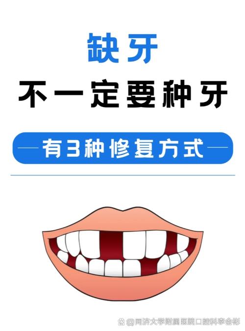 种不棵牙要多久-图2