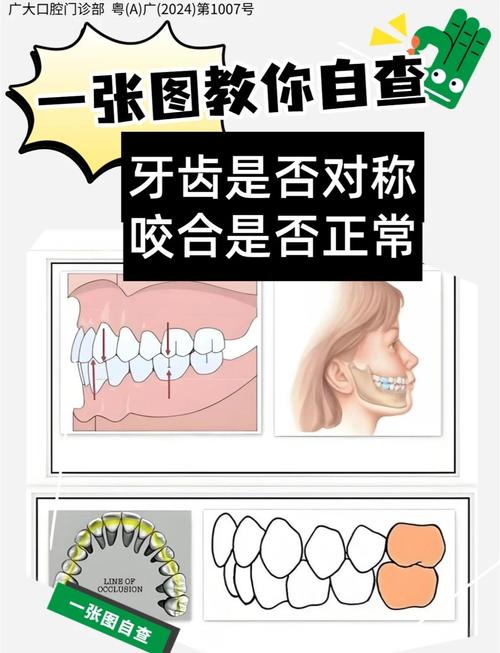 牙齿正畸如何有效调整咬合？-图2