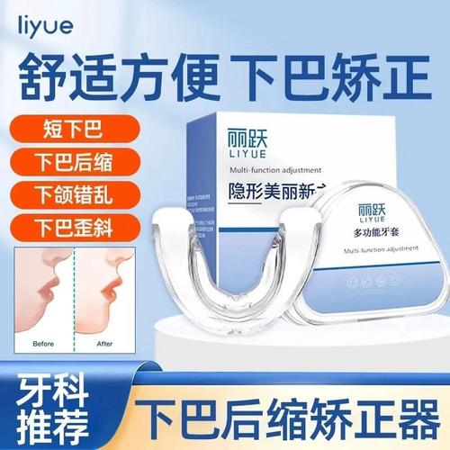 正畸治疗会影响颞下颌关节健康吗？-图2