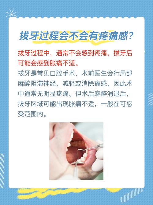 拔牙神经方法有哪些？哪种更安全高效？-图3