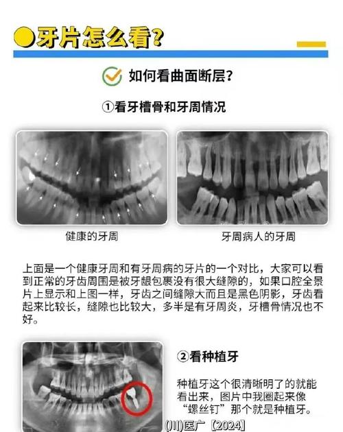 牙齿诊断方法-图3