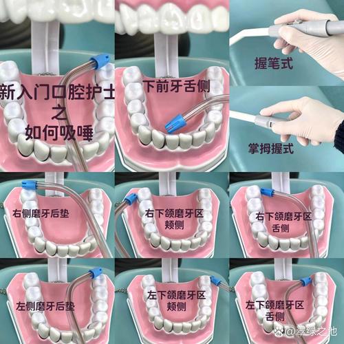 口腔引流方法有哪些？如何根据病情选择合适方式？-图2