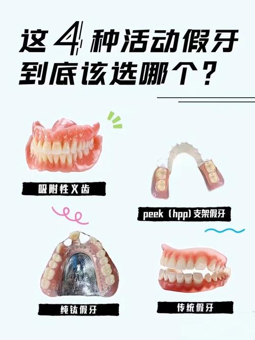 活动镶牙方法-图2