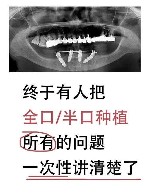 半口牙即种即用靠谱吗？当天种当天用效果如何？-图3