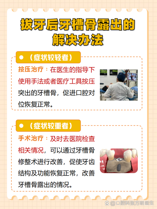 江湖拔牙方法靠谱吗？安全风险大吗？-图1