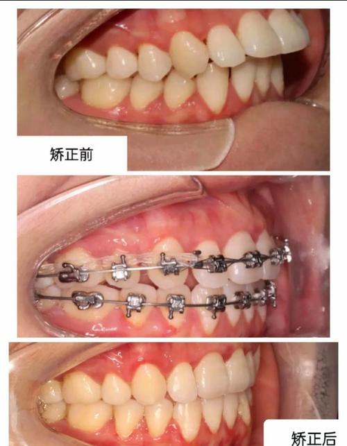 山东省口腔医院 正畸-图3