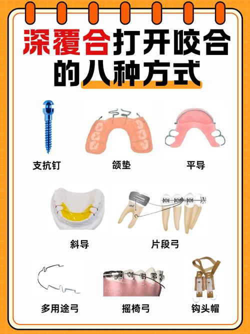 抬高咬合方法-图2