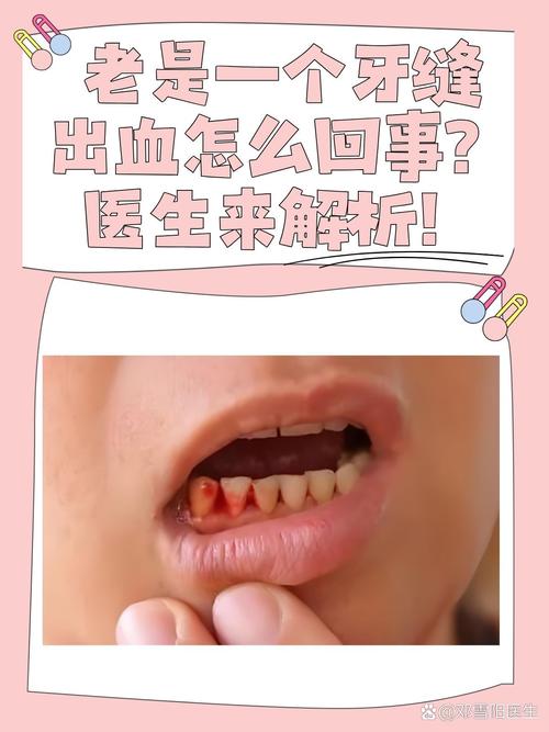 种牙动脉大出血，风险从何而来？如何避免致命伤害？-图1
