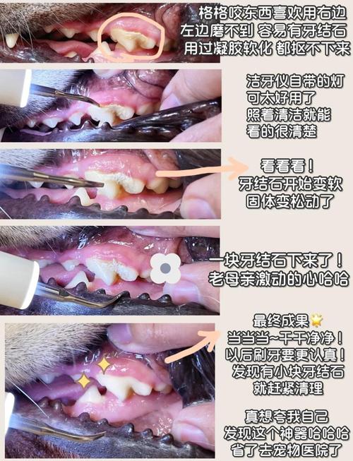 清除牙石方法-图1