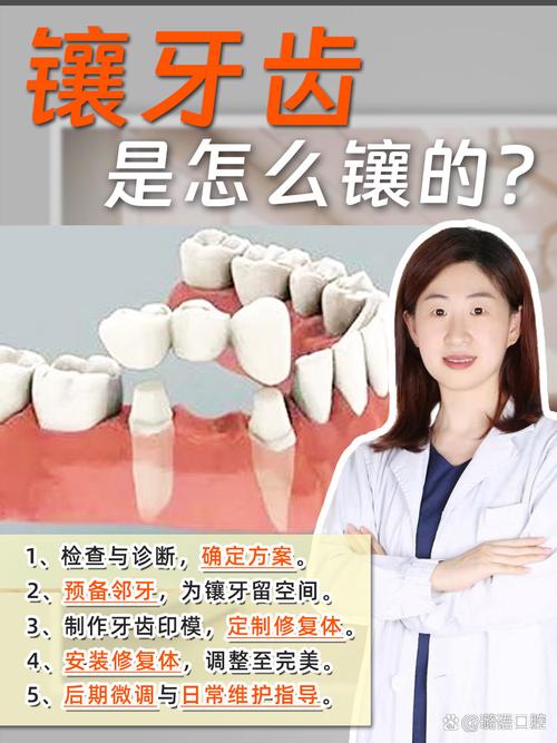 塞牙治疗方法-图3 塞牙治疗方法-图3