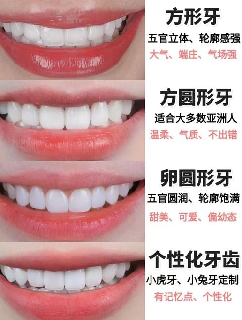 牙齿贴面方法怎么选?哪种更适合自己?-图2 牙齿贴面方法怎么选?哪种更适合自己?-图2