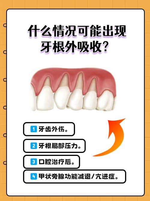 牙根吸收多少不能正畸-图2 牙根吸收多少不能正畸-图2