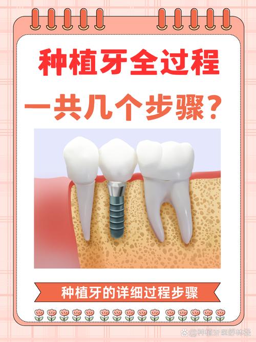 种牙是因为什么-图1 种牙是因为什么-图1