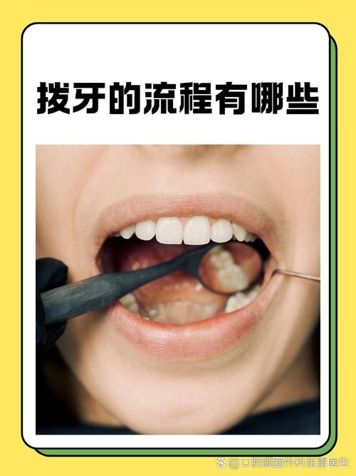 治疗牙的方法-图2