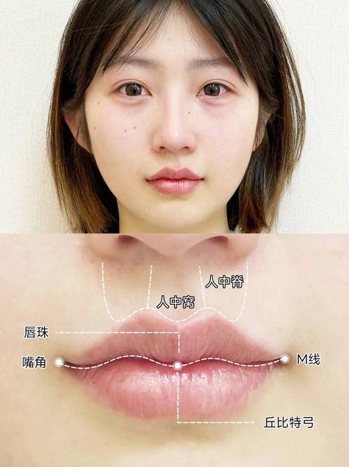 唇弓弯制方法-图3