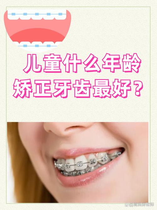 小孩正畸牙齿的最佳矫正年龄是什么时候?-图1 小孩正畸牙齿的最佳矫正年龄是什么时候?-图1