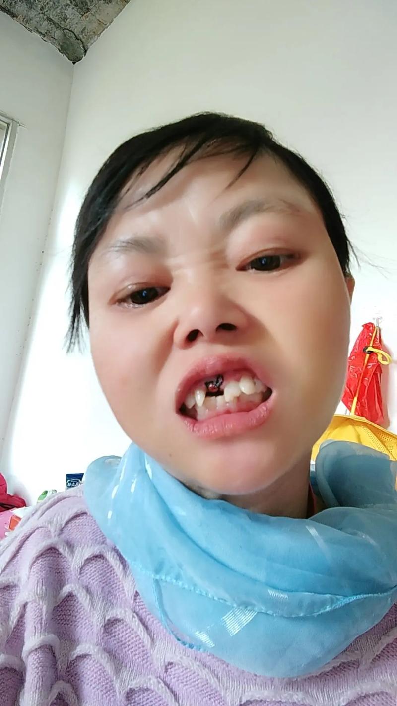 有小孩种牙的吗-图3