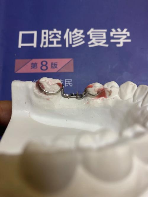 正畸箭头卡弯制步骤如何一步步完成？-图2