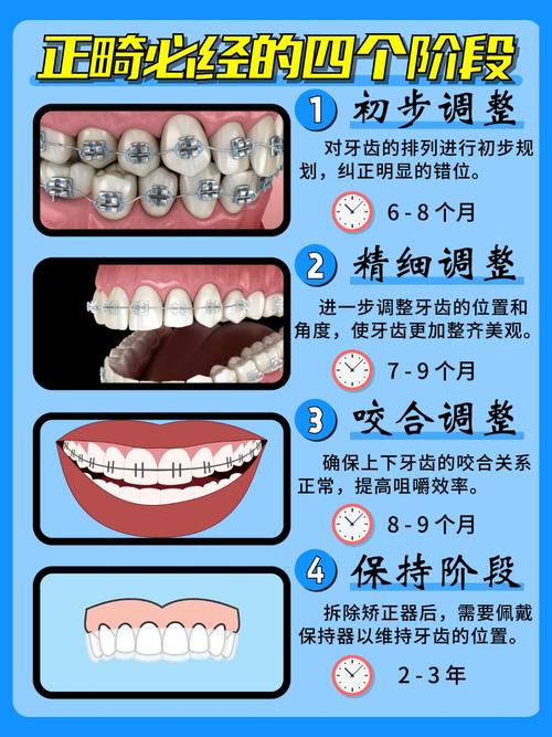成人正畸矫正全程一般需要多长时间？-图1