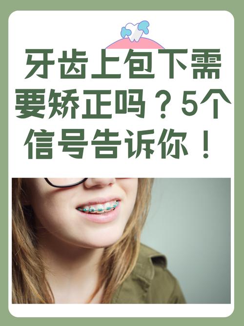 牙齿咬合错位必须正畸-图1