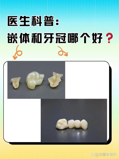 核冠修复和种牙-图3 核冠修复和种牙-图3