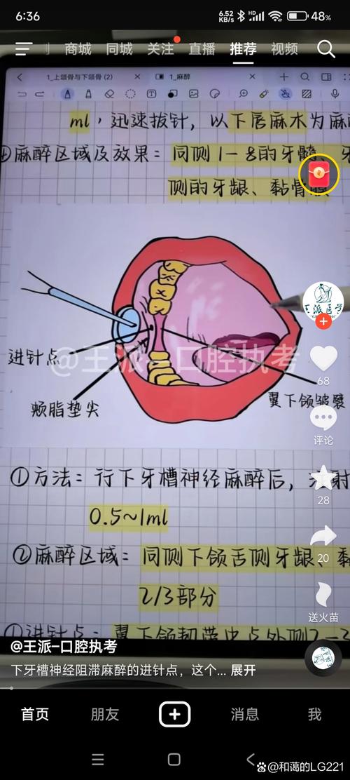 口腔麻醉方法有哪些？如何选择适合的治疗方式？-图2