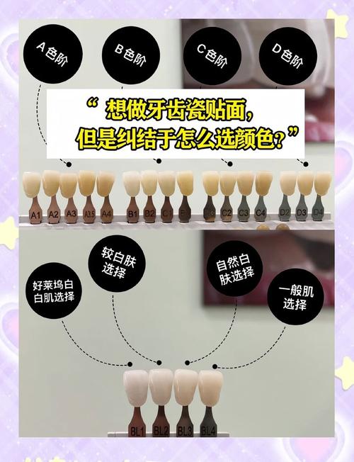 种牙能选牙齿颜色吗？颜色怎么选更自然？-图1