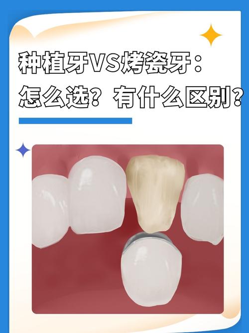 种牙能选牙齿颜色吗？颜色怎么选更自然？-图2