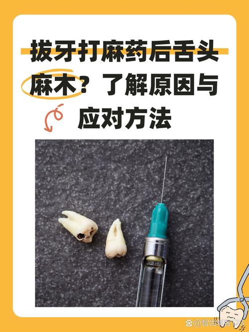 拔牙麻醉方法有哪些?如何选择安全有效的?-图3 拔牙麻醉方法有哪些?如何选择安全有效的?-图3