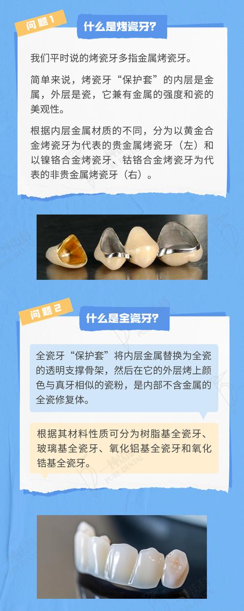 烤瓷牙可不可以正畸-图2