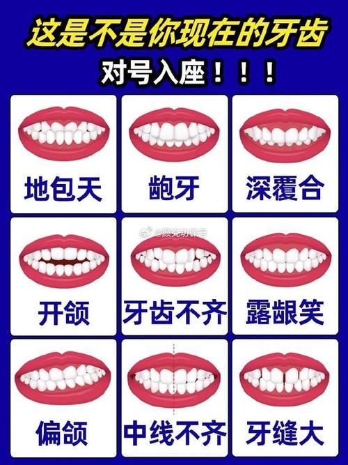 正畸一类二类面型有何区别？如何判断与选择？-图2