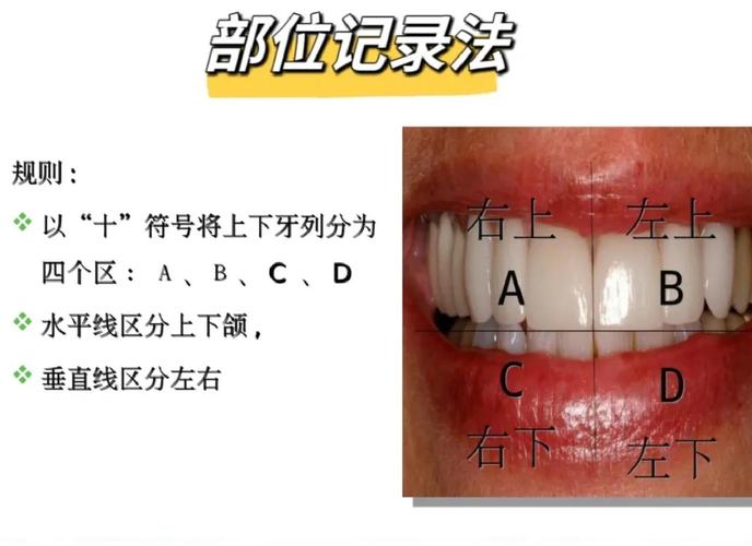 牙位记录方法如何快速准确掌握？-图1