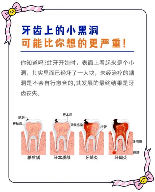 补牙几种方法-图3