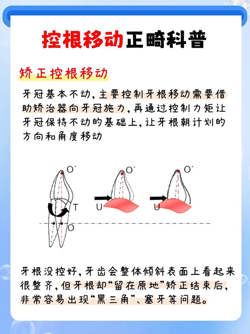 正畸控根是干什么的-图1